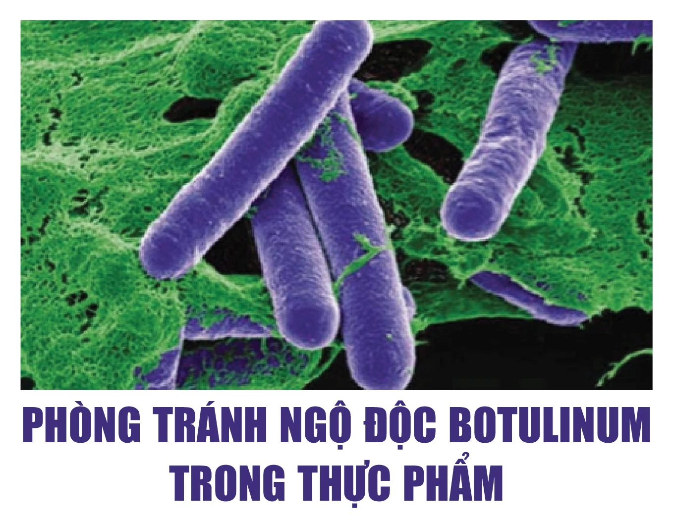 [Infographics] - Phòng tránh ngộ độc Botulinum trong thực phẩm