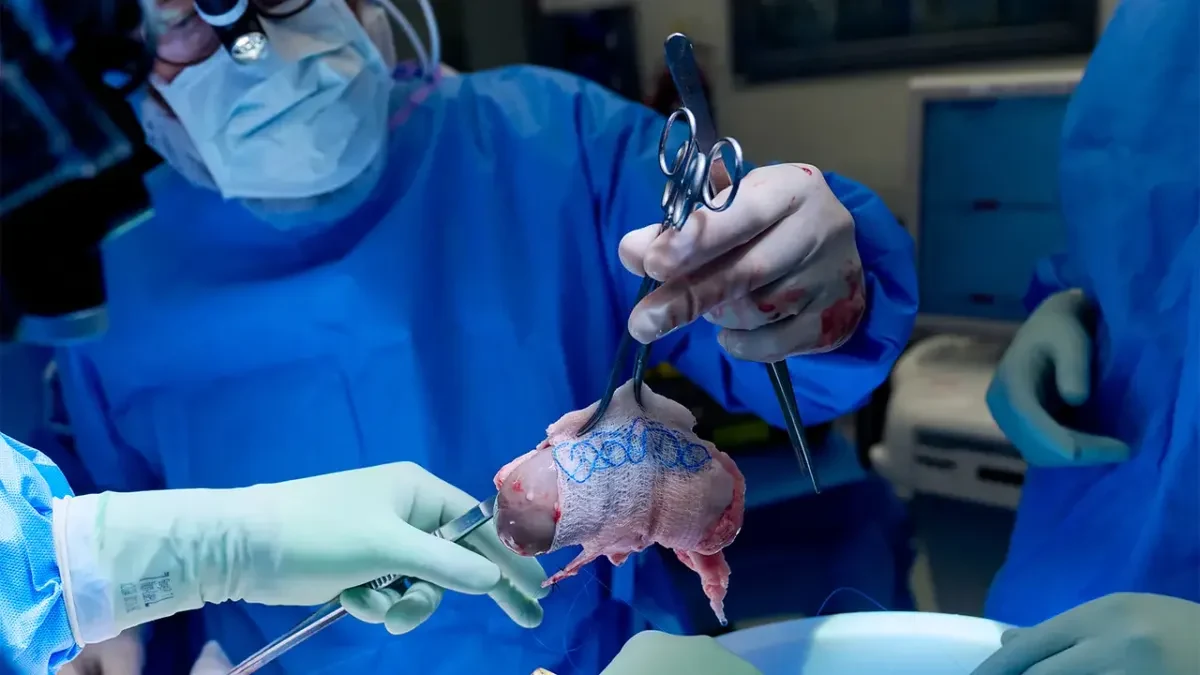 Người phụ nữ phá kỷ lục sống lâu sau ghép nội tạng lợn chỉnh sửa gene
